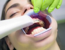 Different Types of Dental Implant Procedures